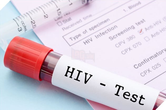 Sau 6 Năm, Anh Chàng Phát Hiện Kết Quả Bệnh Thế Kỷ Chỉ Là Nhầm Lẫn